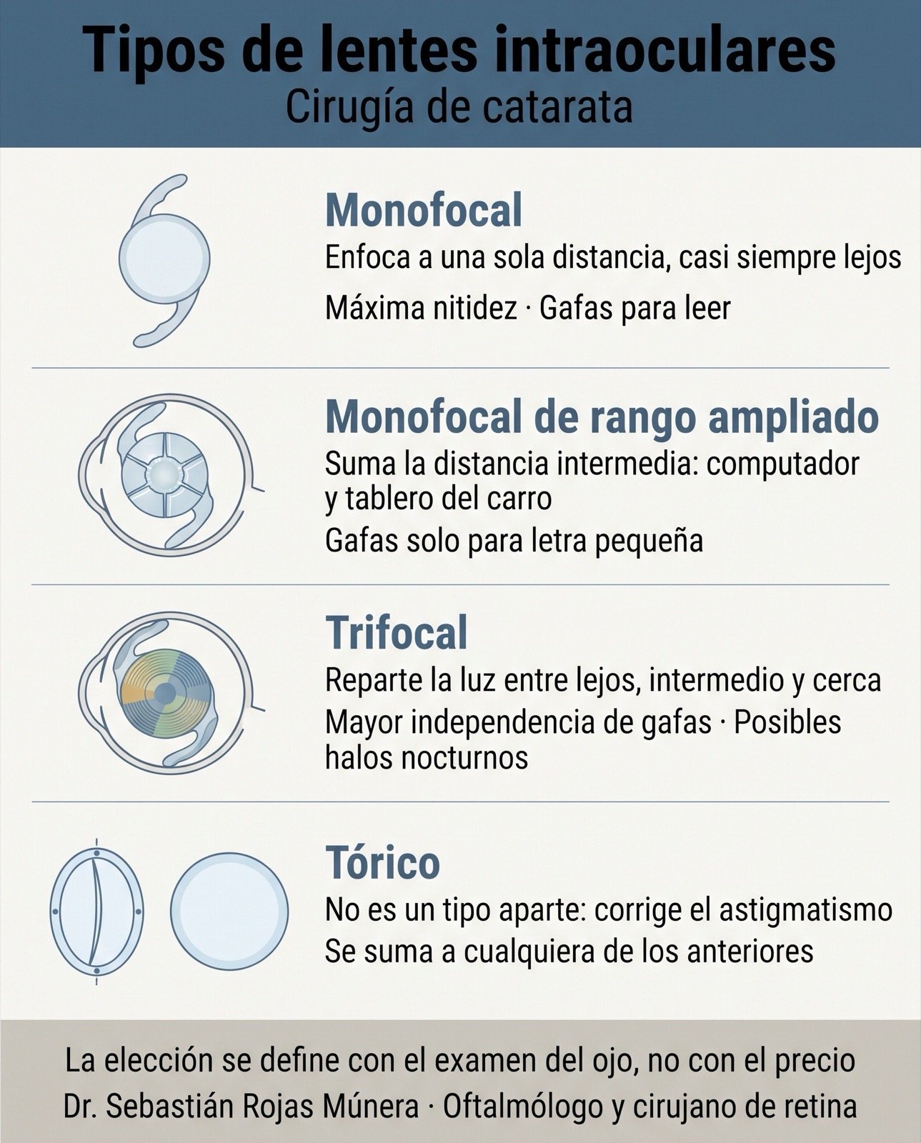 Infografía educativa sobre lentes intraoculares monofocales, de rango ampliado, trifocales y tóricos